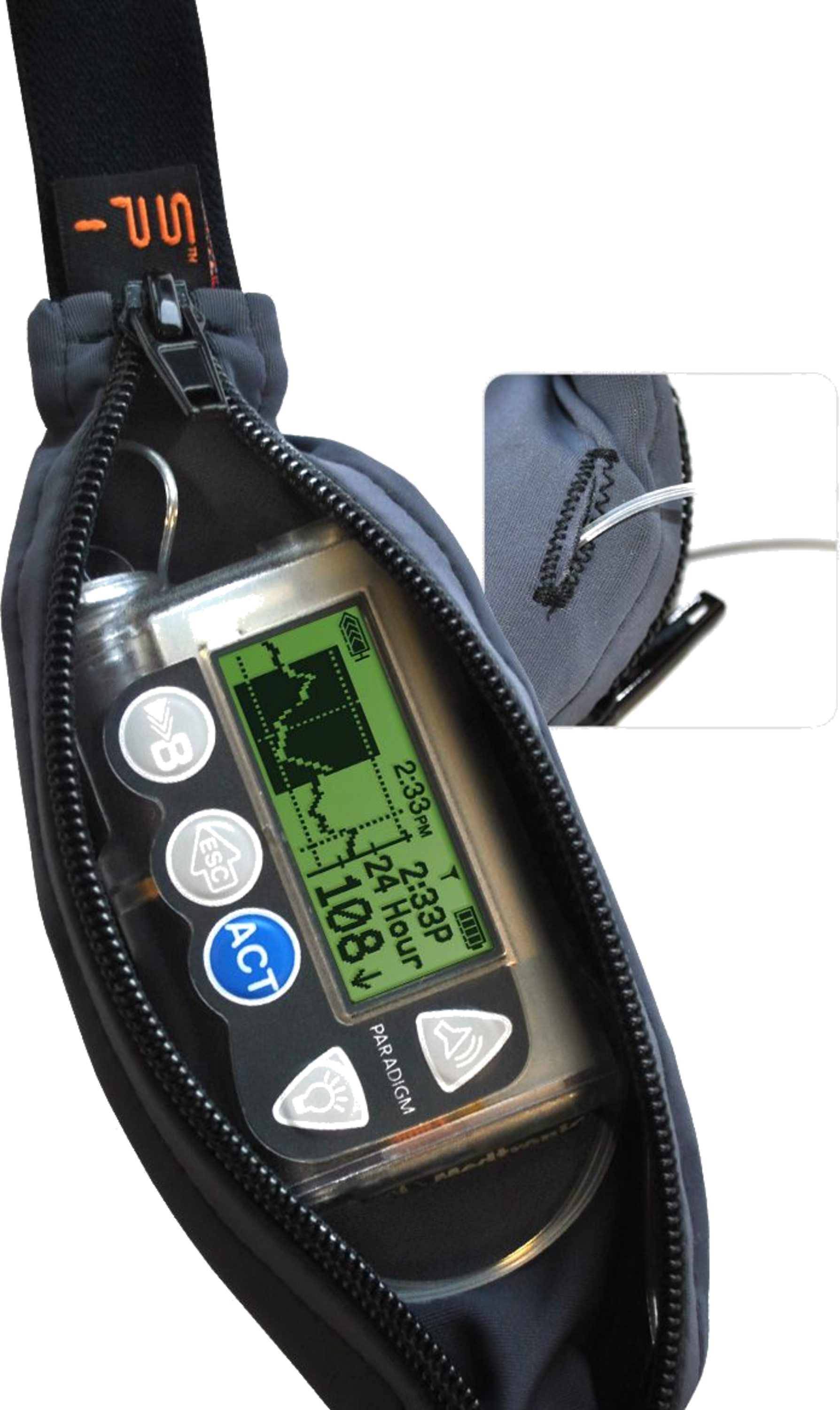 SPIBELT, Spibelt Adult Diabetic Blk With Blk Zipper